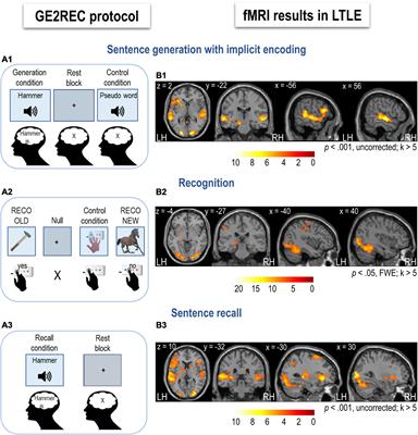 Mapping of Language-and-Memory Networks in Patients With Temporal Lobe Epilepsy by Using the GE2REC Protocol